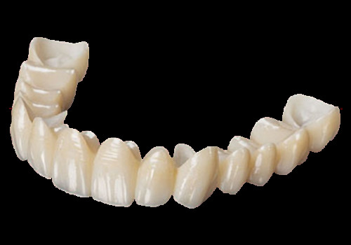 Estetika Tinggi Full Contour Zirconia Crown