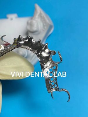 Cetak Scheftner Metal Parsial Denture Frame Tepat Disesuaikan