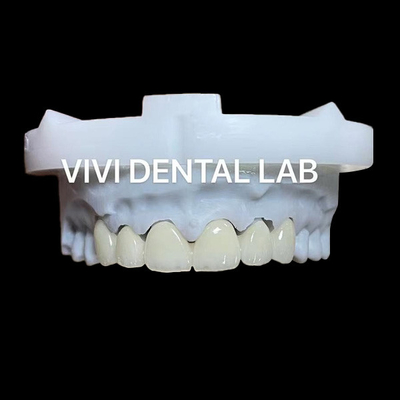 Layered Dental Zirconia Crown And Bridge Translucency 3D PRO