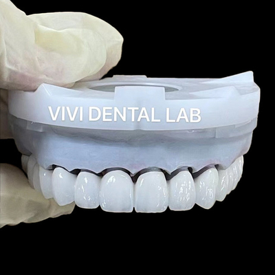 Super Putih Zirconia Dental Lab Mahkota 3D PRO PFZ Noritake Porselen
