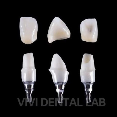 Implan Gigi Tibase Zirconia Abutment Titanium Keakuratan Disesuaikan