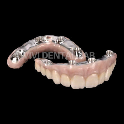 Zirconia Dental Implant Crown Biokompatibel Dengan Titanium Bar