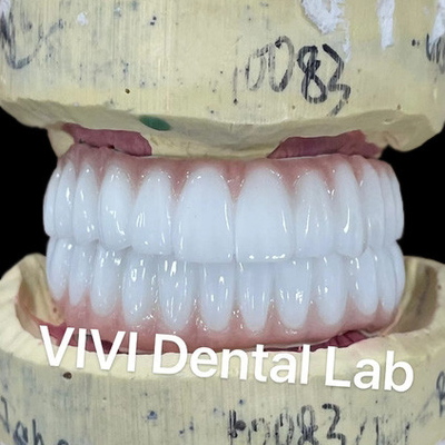 Ni Be Free Zirconia Dental Implant Jembatan Di Bar Estetika Tinggi