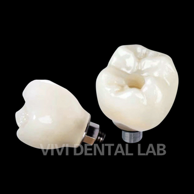 Tulang gigi Implantasi Penangkal Sekrup Crown PFZ Porselen Lapisan Zirconia