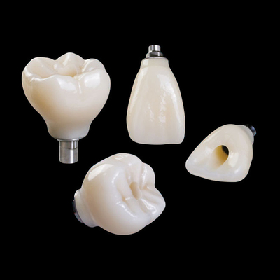 Profesional Zirconia Implan Gigi Mahkota Titanium CAD CAM