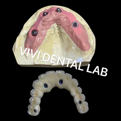 Semua di atas empat Zirconia Bridge Ivoclar Dental Keakuratan tinggi