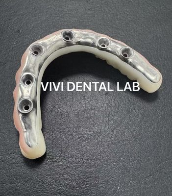 Estetika Jembatan Zirconia penuh dengan Titanium Bar screwed ditahan dari China laboratorium gigi