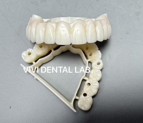 total Jembatan Zirkonia Penuh Screw China dental lab