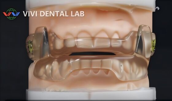 Perangkat Dorsal Snoring China laboratorium gigi