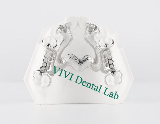 Skelet Chrome Metal Parsial Dental Printed CoCr Denture Design