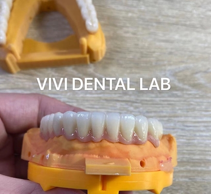 Full Jaw Dental Zirconia Bridge Implantasi Mahkota Translucence Estetika