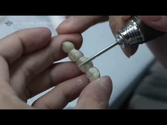 Jembatan Keramik Logam