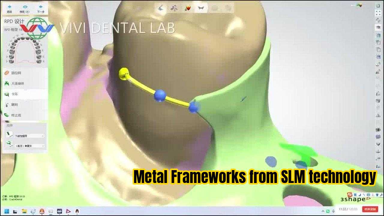 Cina VIVI DENTAI LABORATORY Sertifikasi
