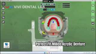 Gigi Tiruan Akrilik Giling Superior Fit Digital